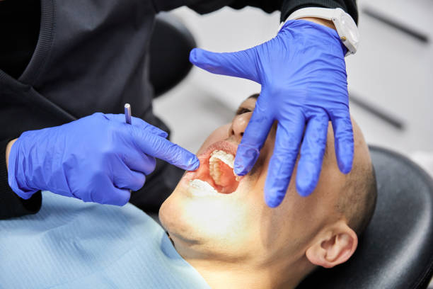 Best Emergency Tooth Extraction in Justice, IL